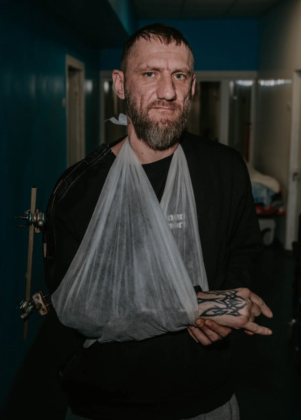 Фото до матеріалу: У Черкасах врятували руку військовому, який 25 кілометрів ішов з розтрощеною кінцівкою