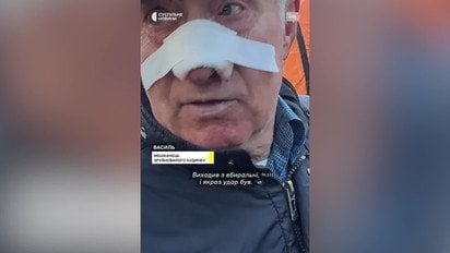 Фото до матеріалу: Киянин розповів, як дивом пережив пекельний обстріл столиці