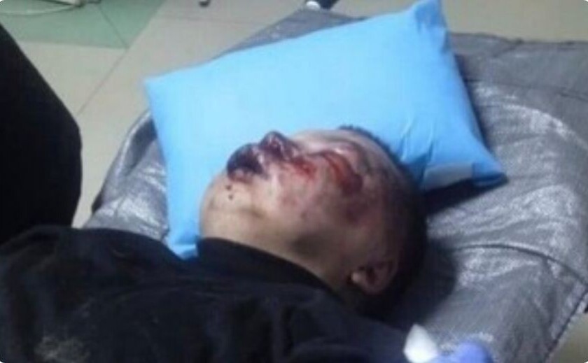 Фото до матеріалу: У Шахтарському затримали трьох військових за викрадення та побиття цивільного