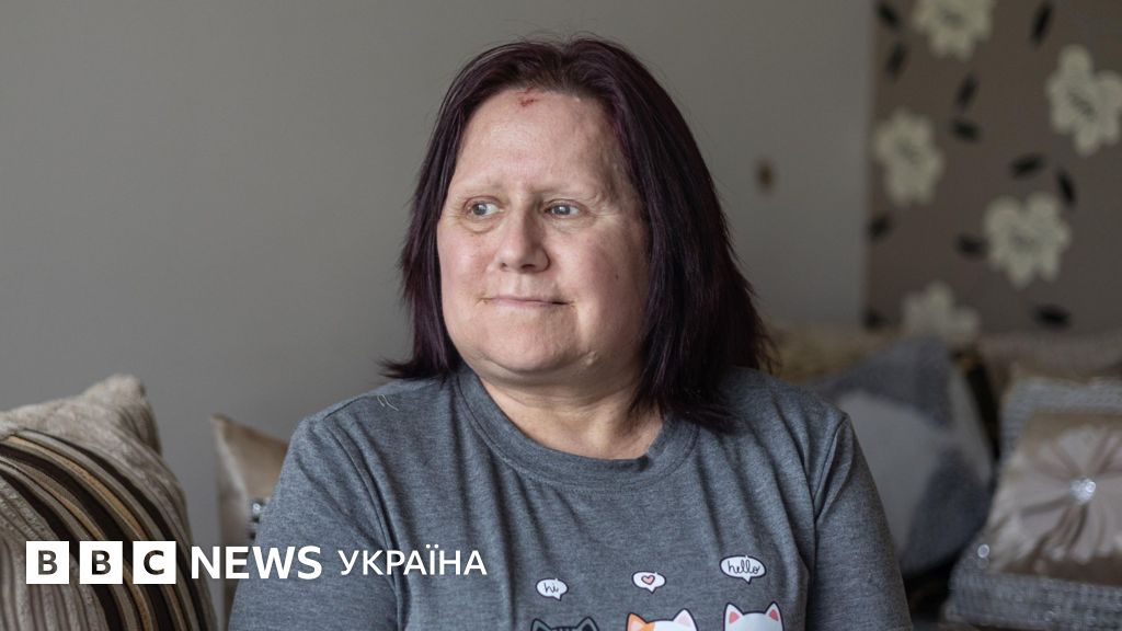 Фото до матеріалу: Жінка з Уельсу розповіла, як пограбування допомогло притягнути батька до відповідальності