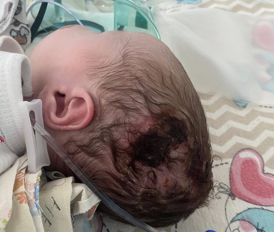Фото до матеріалу: Трагедія у Вишгороді: батьки звинувачують лікарку в смерті дитини та тяжких травмах іншої