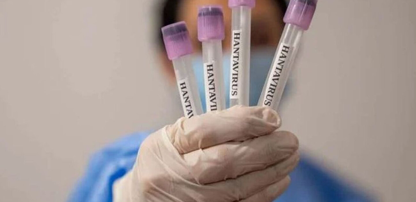 Фото до матеріалу: Франція посилює карантин через хантавірус: евакуйовані пасажирки та контакти