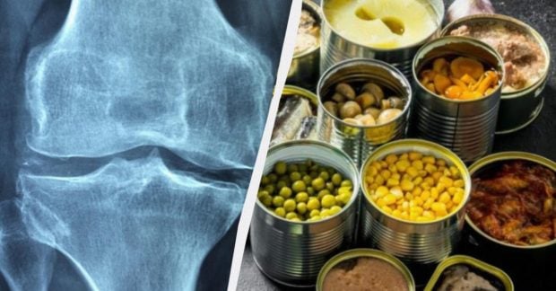 Фото до матеріалу: Лікарка з Києва назвала найкращий продукт для зміцнення кісток після 50 років