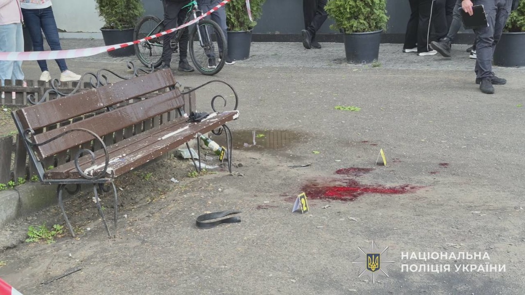Фото до матеріалу: Чоловік підірвав гранату в Охтирці: п'ятеро поранених, затримано