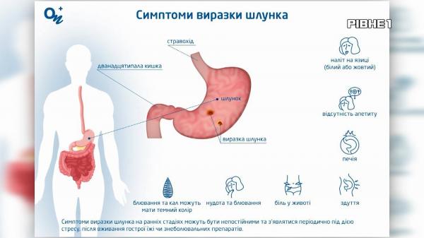 Фото до матеріалу: Як повернути природний вигляд зубів без складних втручань і довгого лікування. Лікування. Здоров'я