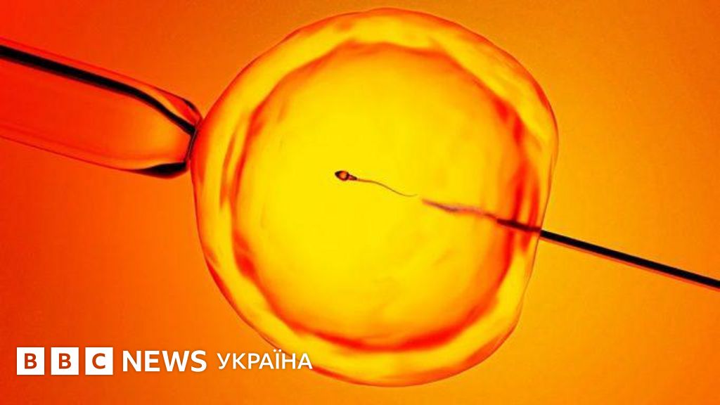 Фото до матеріалу: Штучний інтелект знайшов приховані сперматозоїди: нова надія для українських сімей із діагнозом азооспермія