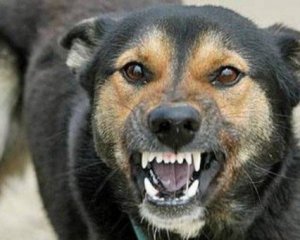 Фото до матеріалу: Що робити, якщо укусила собака чи дика тварина: поради лікарів