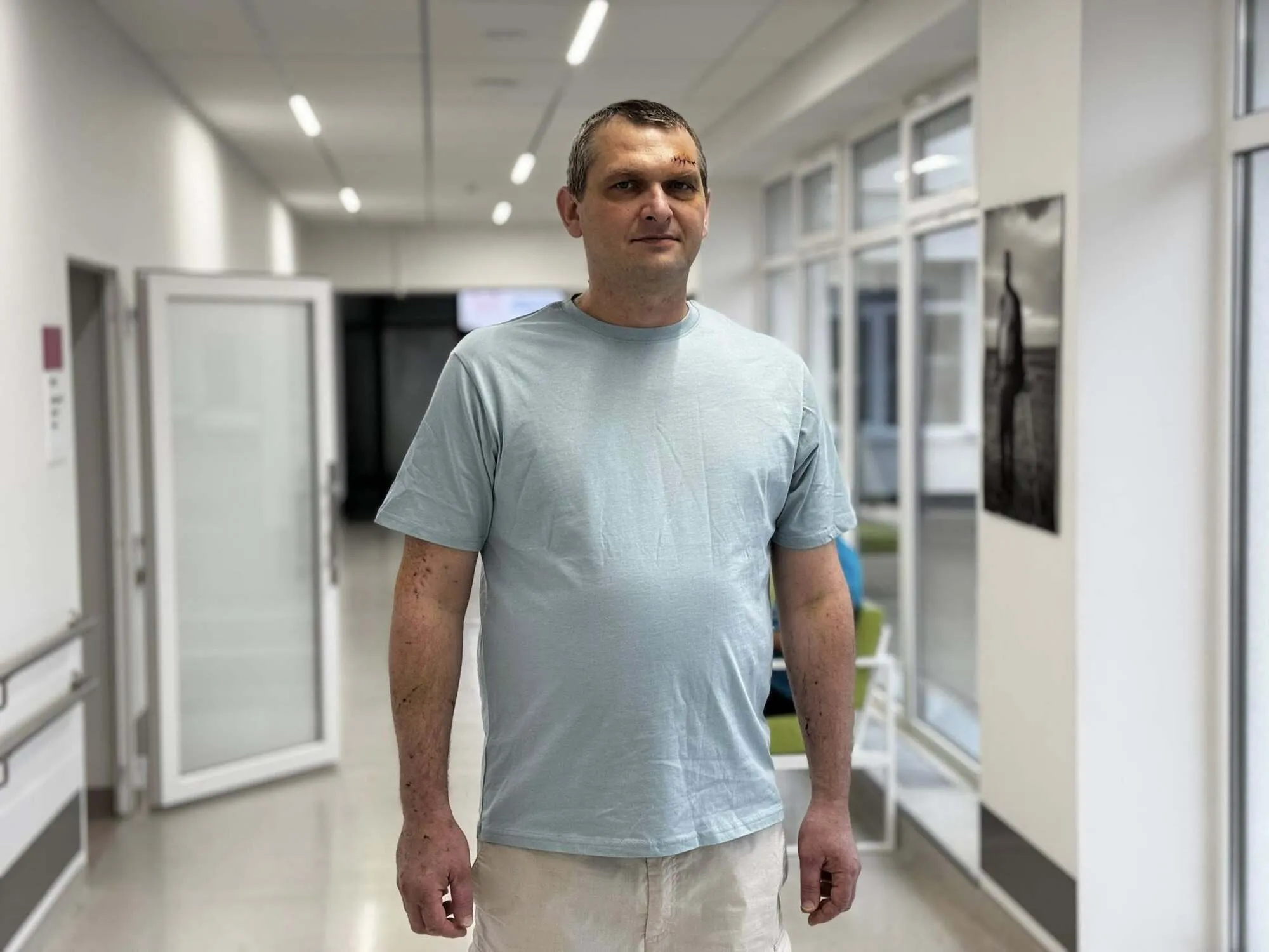 Фото до матеріалу: У Львові медики врятували чоловіка після атаки дронів: у легені застряг уламок скла