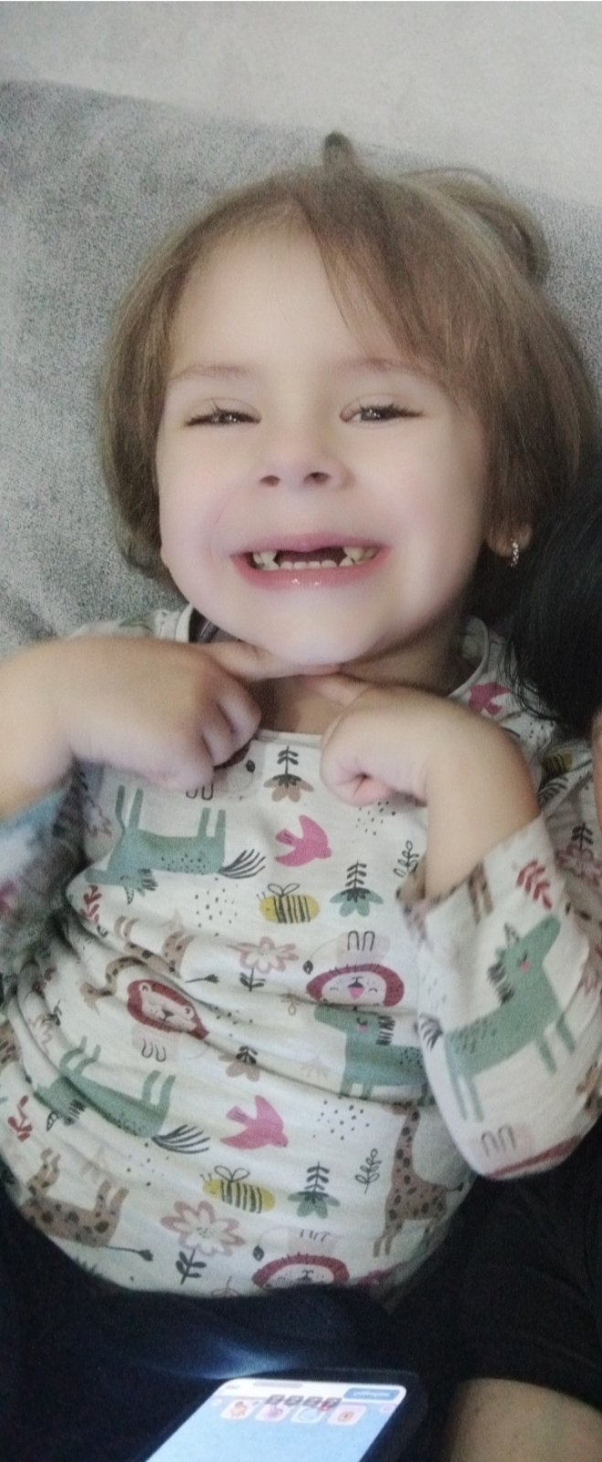 Фото до матеріалу: У Львові хірурги врятували життя лучанці з рідкісною пухлиною на нирках