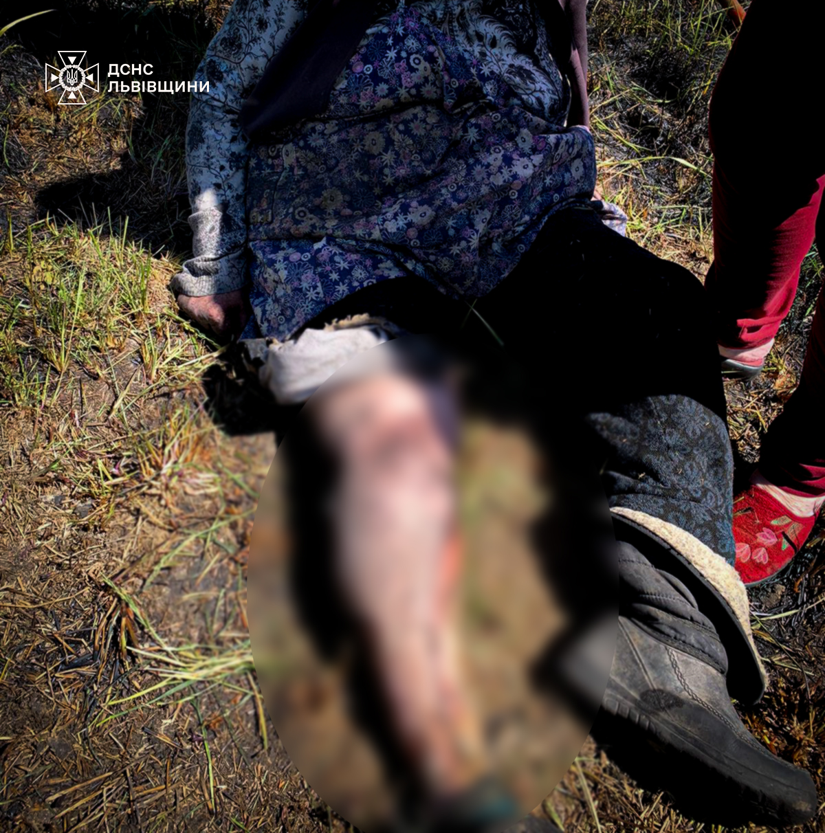 Фото до матеріалу: Жінка опіклася спалюванням сухостою в селі Підгірці на Стрийщині