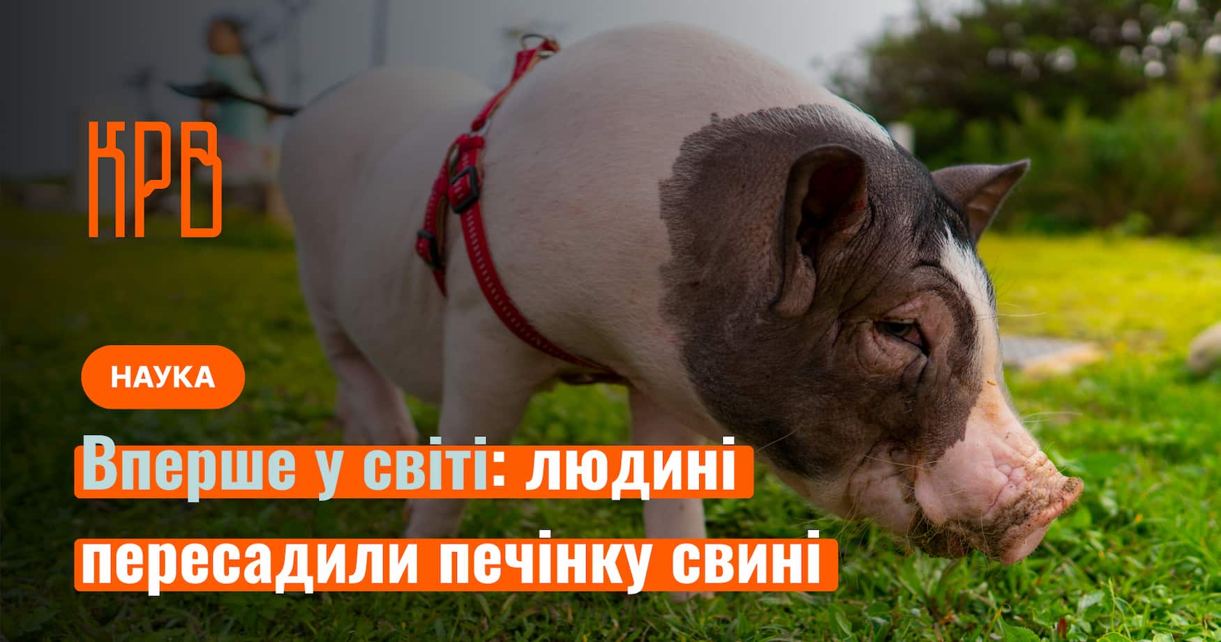 Фото до матеріалу: Історичний прорив у медицині: вперше людині пересадили печінку свині