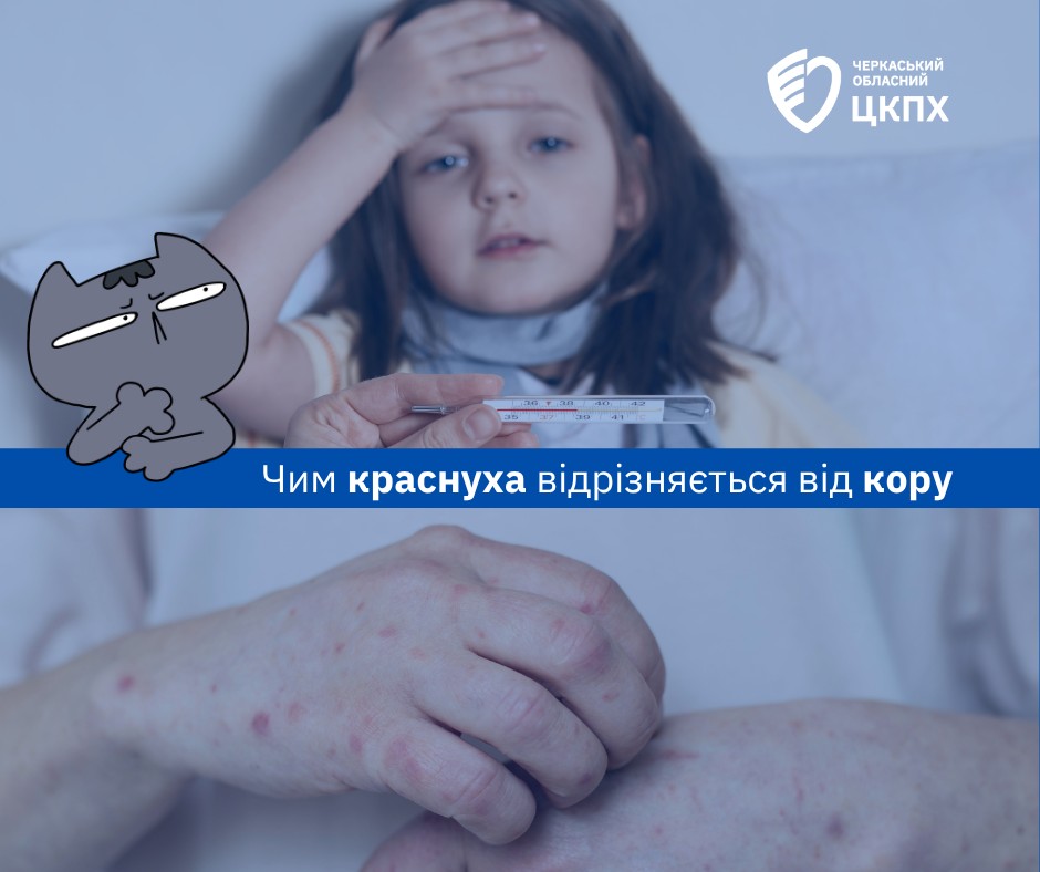 Фото до матеріалу: Кір чи краснуха: як розпізнати небезпечні інфекції та чому в Черкасах зараз спокійно