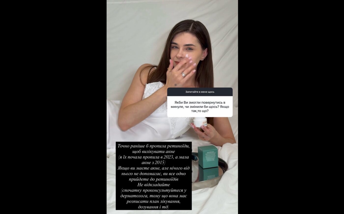 Фото до матеріалу: Ретиноїди Катерини Остапчук: як системне лікування допомогло подолати важке акне