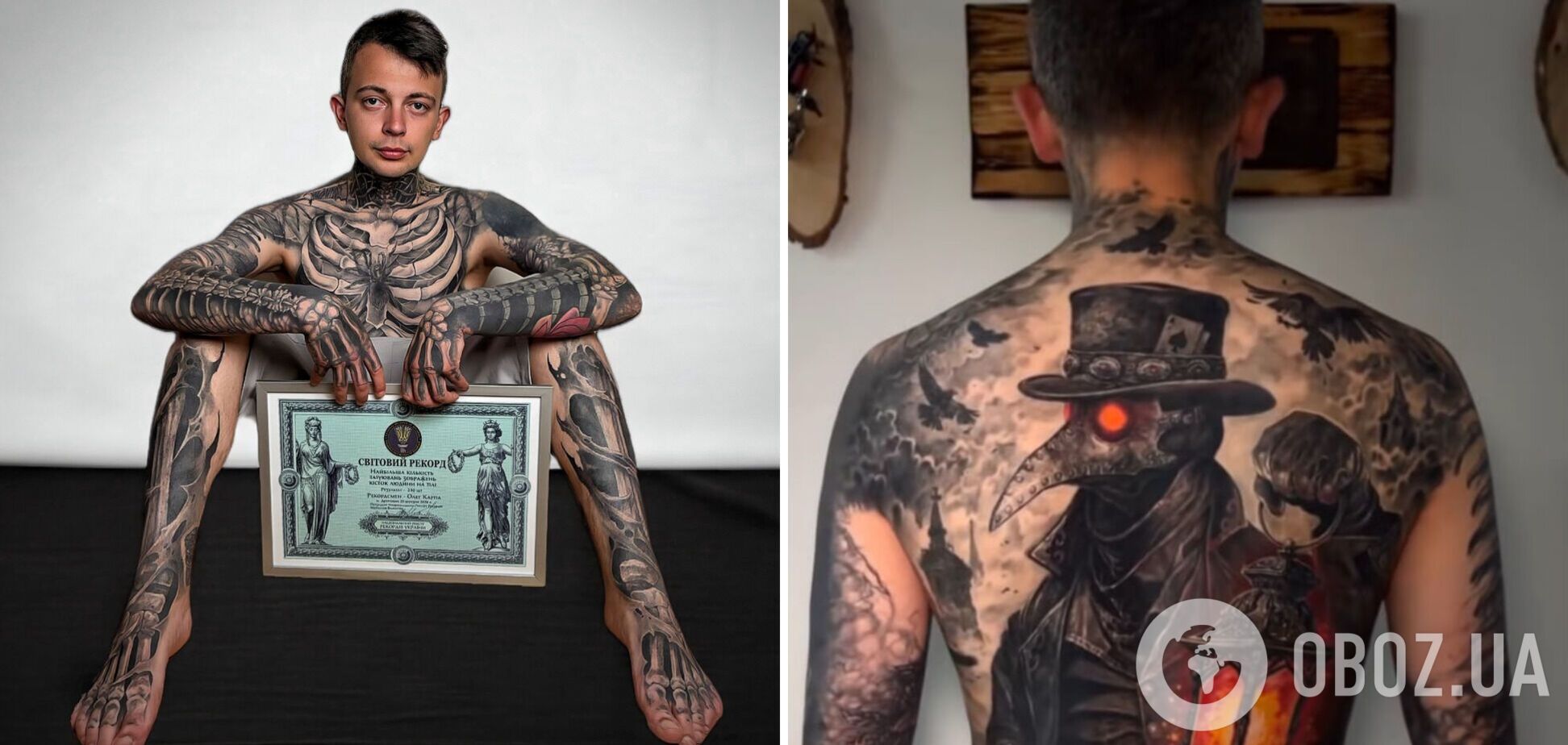 Фото до матеріалу: Перевершив Zombie Boy: медик із Дрогобича набив 230 татуювань кісток і встановив світовий рекорд. Фото