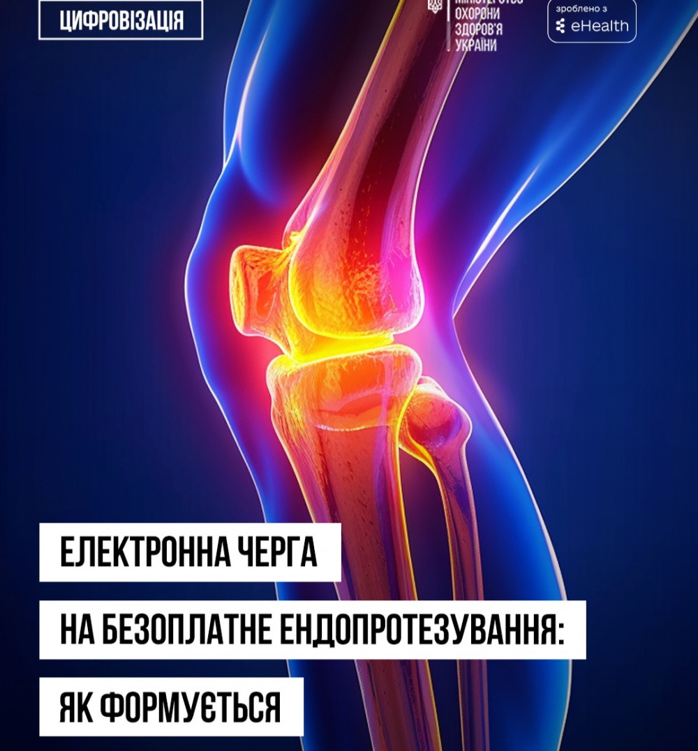 Фото до матеріалу: П'ять лікарень Івано-Франківщини запропонували безоплатне ендопротезування суглобів