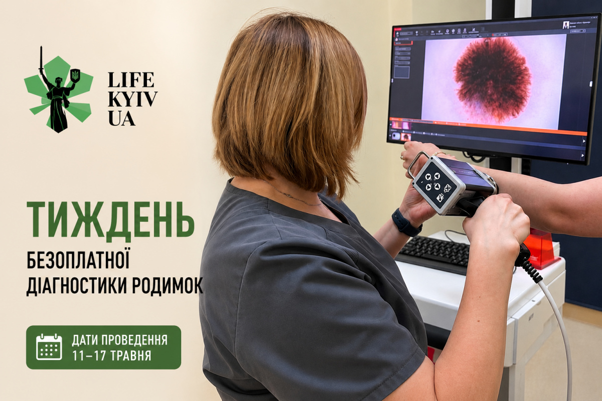 Фото до матеріалу: Безкоштовна діагностика родимок у Києві: де та коли пройти огляд