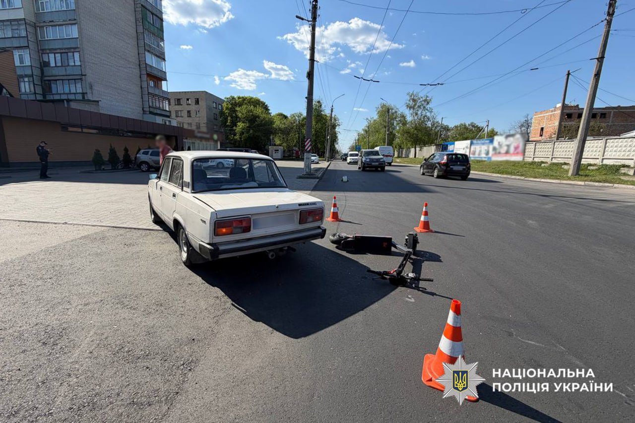 Фото до матеріалу: ДТП на Одеській у Черкасах: 13-річний хлопець на самокаті потрапив до лікарні