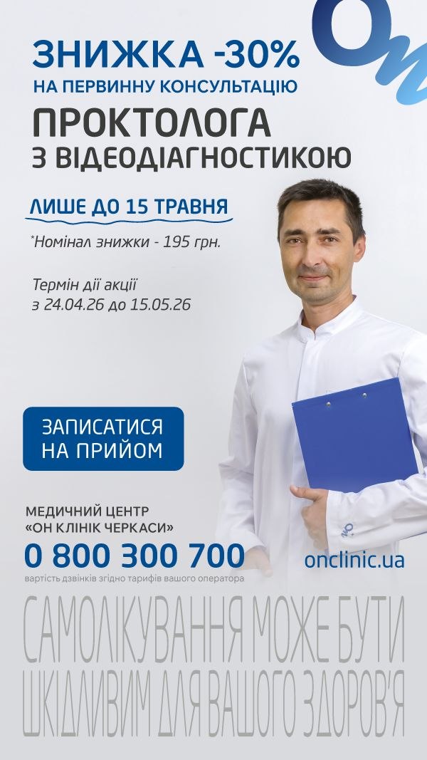 Фото до матеріалу: У Черкасах триває модернізація пляжу «Дахнівський»: встановили нові перголи та паркан