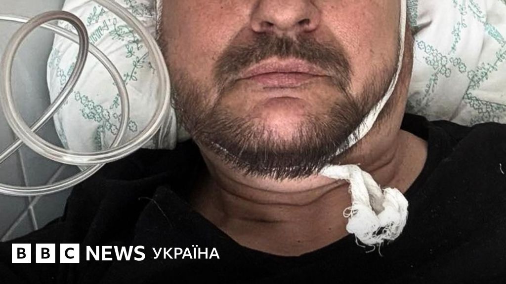 Фото до матеріалу: В Києві відомий будинок став ціллю ворожого атаки: що відомо про інцидент із Флешем