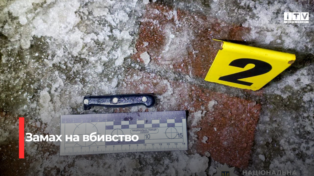 Фото до матеріалу: До 10 років ув’язнення загрожує зловмиснику за замах на вбивство рівнянина