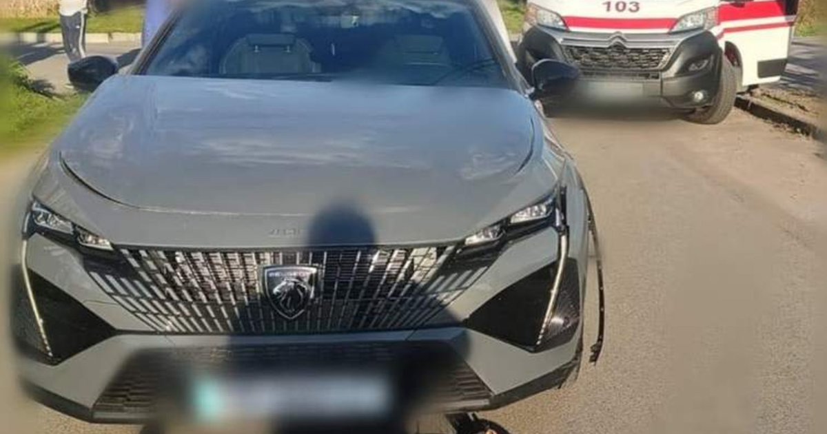 Фото до матеріалу: У Фастівському районі водій Peugeot збив десятирічного хлопчика на самокаті