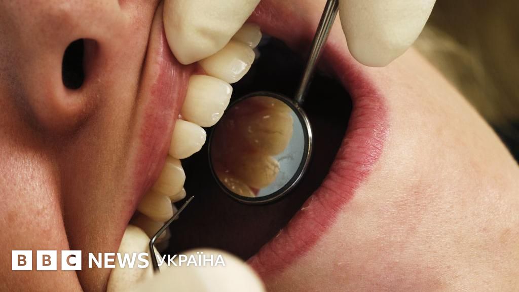 Фото до матеріалу: Сідней: тисячі пацієнтів стоматолога перевіряють на ВІЛ та гепатити