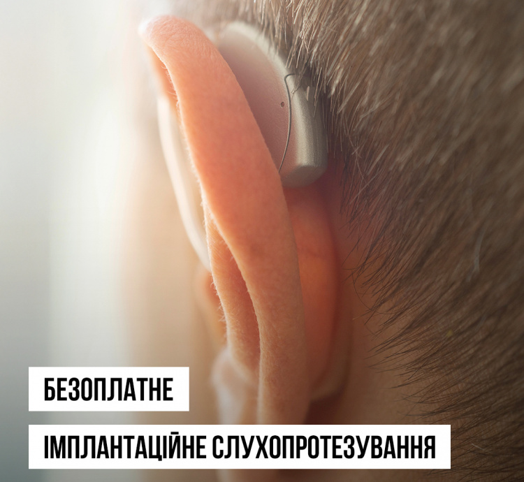 Фото до матеріалу: Безоплатні імпланти слуху: хто може їх отримати в Україні