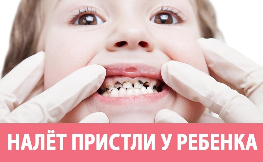 Фото до матеріалу: Енциклопедія медицини: серцево-судинні захворювання та електрокардіостимулятори