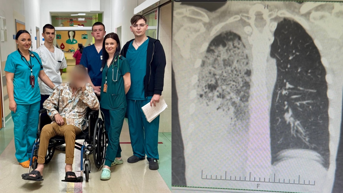 Фото до матеріалу: Медики Франківської ЦМКЛ врятували життя нацгвардійця з двобічною пневмонією