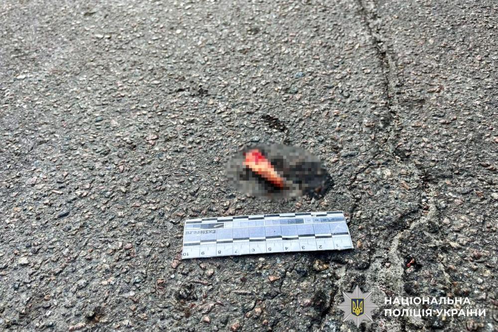 Фото до матеріалу: Пасажирка мотоцикла померла після 8 місяців боротьби за життя