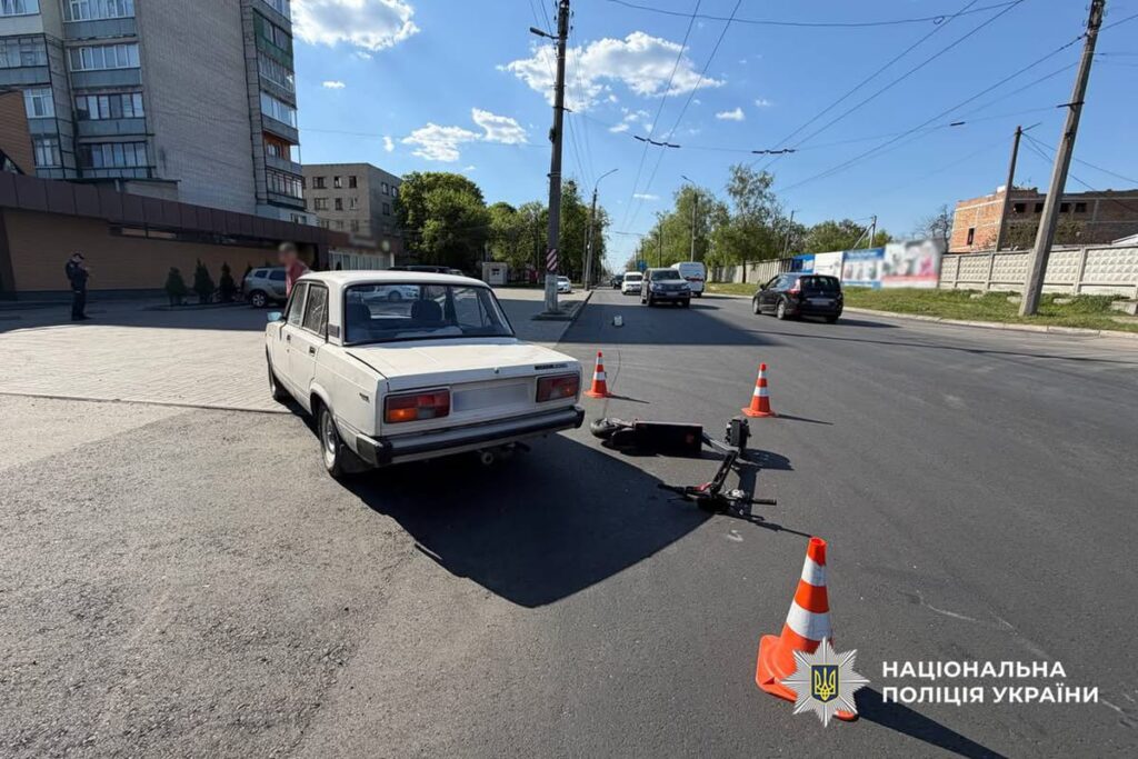 Фото до матеріалу: 13-річний хлопець потрапив у лікарню після зіткнення з авто у Черкасах