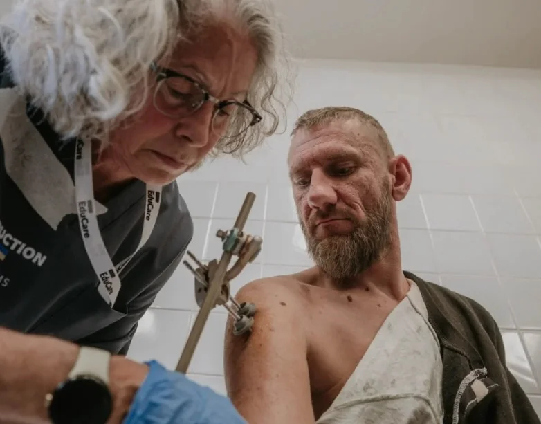 Фото до матеріалу: У Черкасах врятували руку захисника: міжнародна команда провела унікальну мікрохірургічну операцію