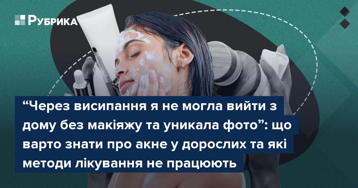 Фото до матеріалу: Акне у дорослих: що це за хвороба, які методи лікування працюють, а які — ні