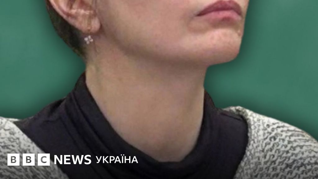 Фото до матеріалу: Судова справа поліцейської Анни Дудіної: офіційна позиція про втечу від пострілів не була визнана