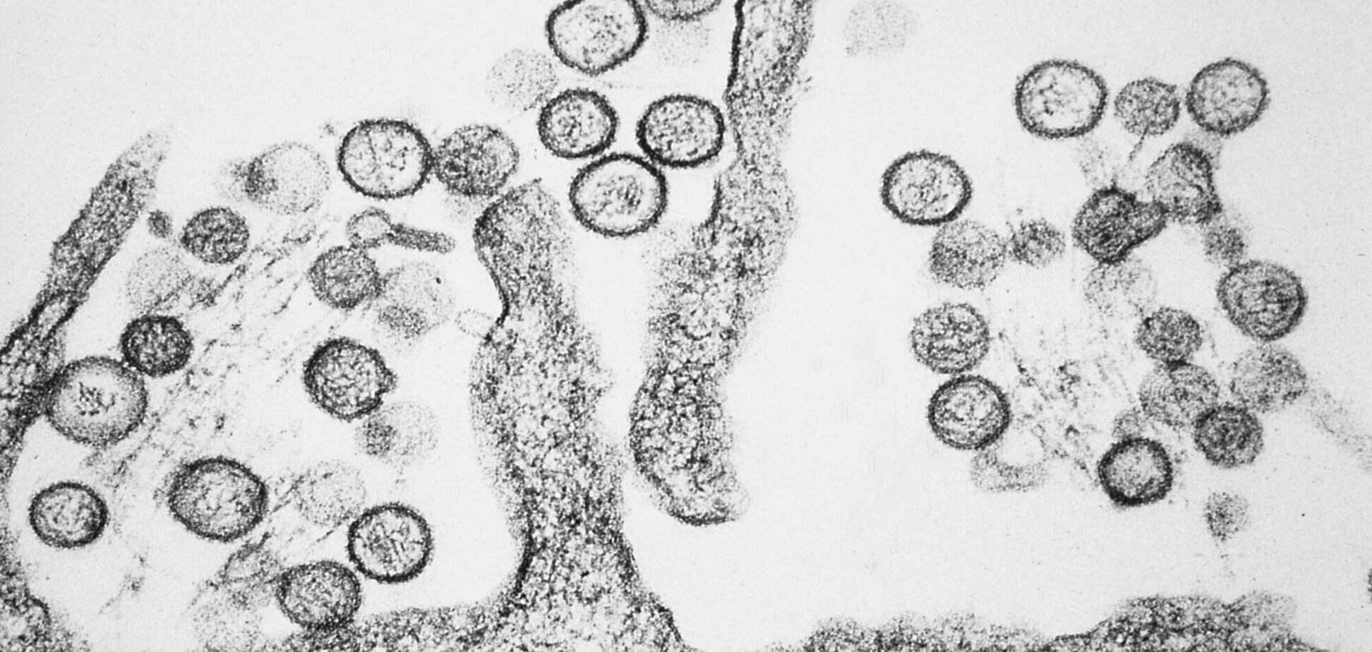Фото до матеріалу: Хантавірус є побічним ефектом вакцини від COVID-19? Медіа розібрали сенсацію з соцмереж