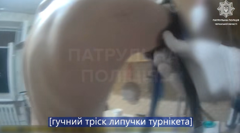 Фото до матеріалу: У Черкасах рятували чоловіка з кровотечею на бульварі Шевченка: деталі інциденту