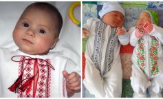 Фото до матеріалу: Жінка після пологів вижила після рідкісної інфекції: історія Чарлі про боротьбу з м'ясоїдними бактеріями