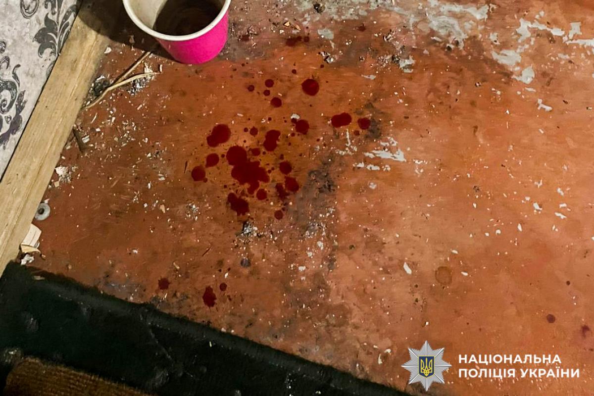Фото до матеріалу: У селі Орлівка чоловік напідпитку завдав дружині ножову рану через ревнощі