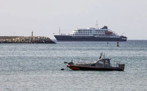Фото до матеріалу: Дитячий крем не допомагає сухій шкірі, а робить ще гірше