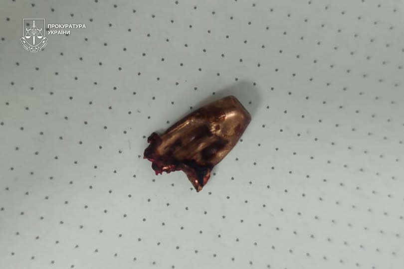 Фото до матеріалу: Полянецький лісник підозрюють у вбивстві через необережність на Закарпатті