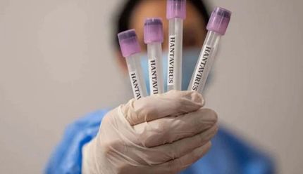 Фото до матеріалу: Франція посилює карантин через хантавірус: евакуйовані пасажирки та контакти