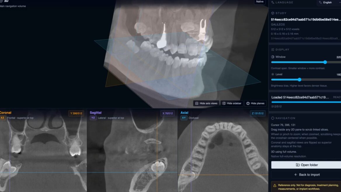 Фото до матеріалу: Український розробник з Wix створив безкоштовний 3D-переглядач КТ-знімків у браузері