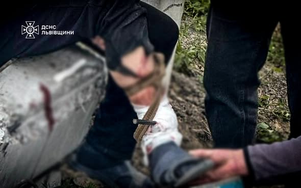 Фото до матеріалу: Рятувальники звільнили ногу мотоцикліста, яку проштрикнула арматура зі стовпа