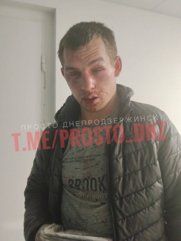 Фото до матеріалу: На Дніпропетровщині група молодиків жорстоко побила підлітка та його брата: всі подробиці скандальної справи